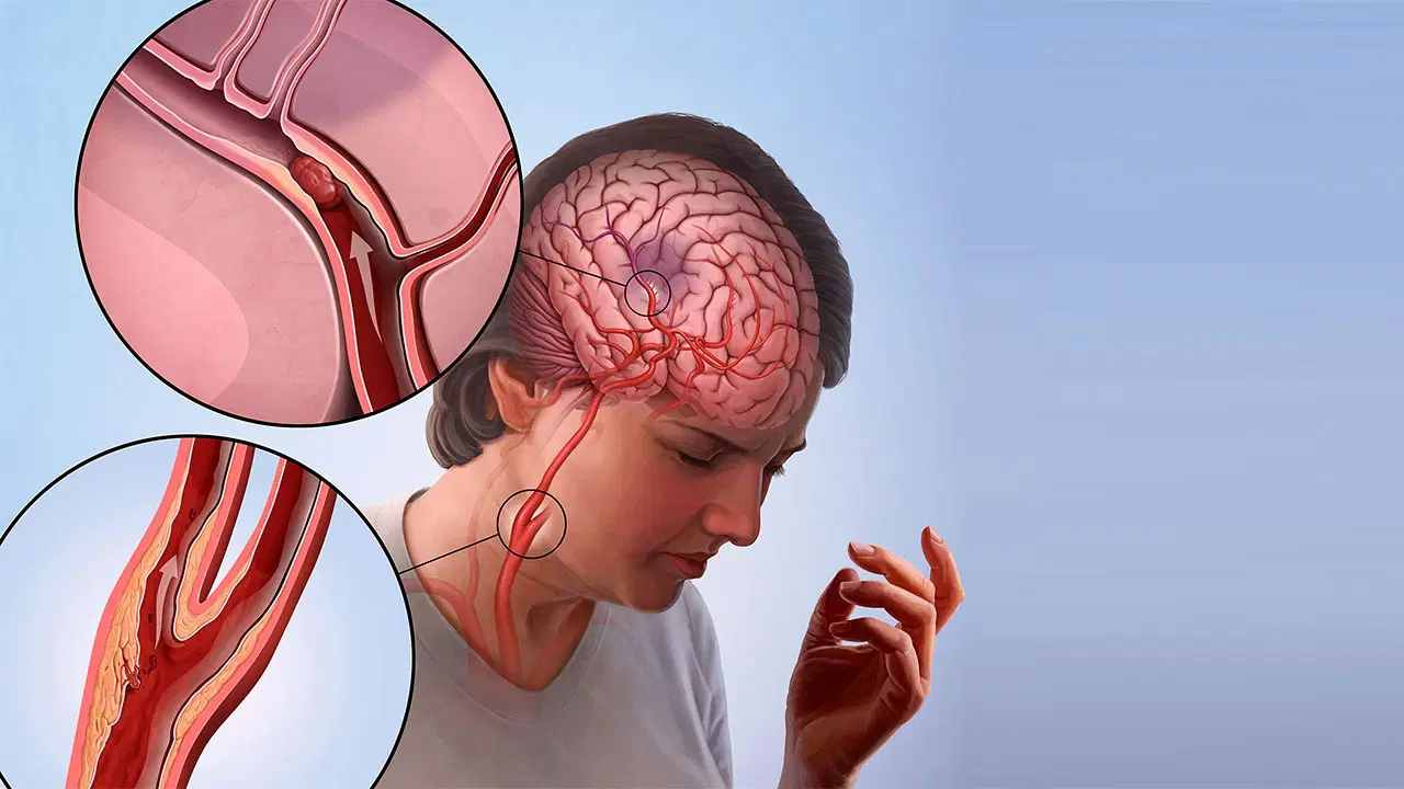 turkiyede bu sebepten dolayi her yil 45 bin insan oluyor haNVejqr