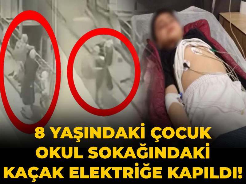 8-yasindaki-cocuk-okul-sokagindaki-kacak-elektrige-kapildi-annesi-omrumuzden-gitti-diyerek-anlatti-l4NtYrqF